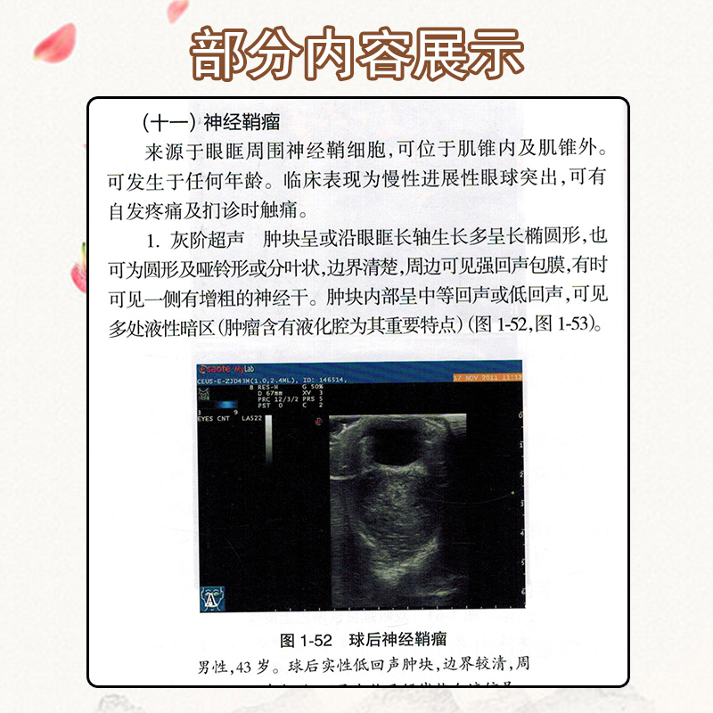 正版现货 现货中国浅表器官超声检查指南/中国医师协会超声医师分会指南丛书 人民卫生出版社9787117242530 - 图3