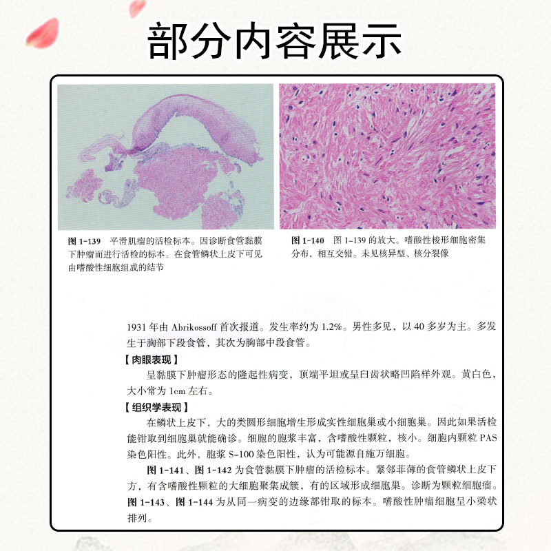 正版 消化道病理及活检诊断图谱 辽宁科学技术出版社9787559123503 - 图3