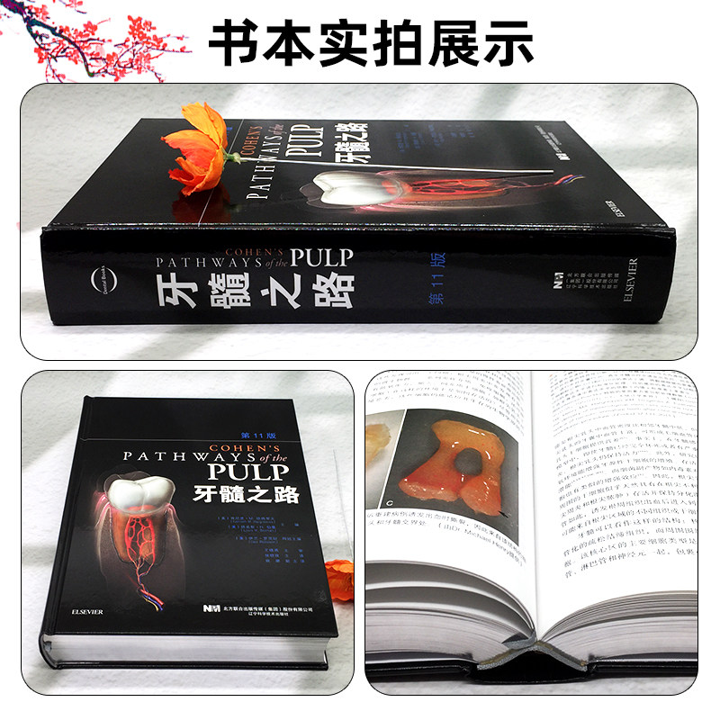 任选 牙髓之路第11版 侯晓玫 根管治疗图谱正畸书籍拔牙技巧 根管治疗书籍口腔种植书籍 口腔医学书籍牙科书籍 辽宁科学技术出版社