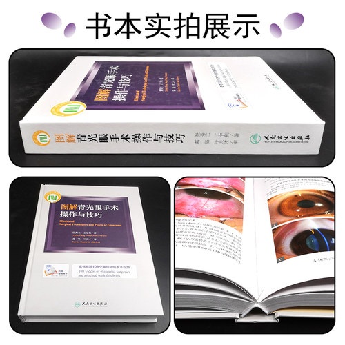 正版 图解青光眼手术操作与技巧 超值附赠108个网络增值视频 张秀兰 王宁利著 人民卫生出版社9787117228190 - 图1