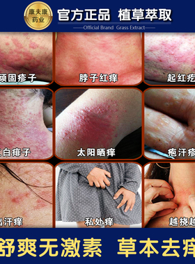 皮肤痒痱子膏湿热痒皮干痒草本乳膏红点热疙瘩痒脖子出汗痒腿根痒