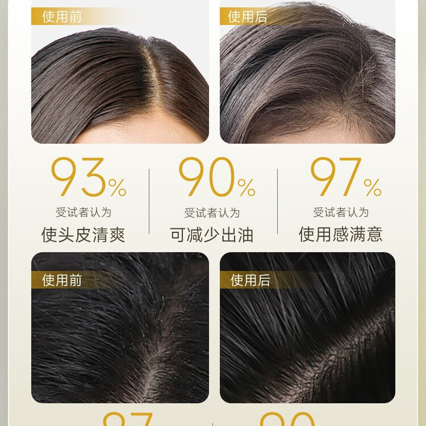 澳洲菲诗蔻洗发水植物去屑桉树玻尿酸咖啡姜精华生姜洗发液