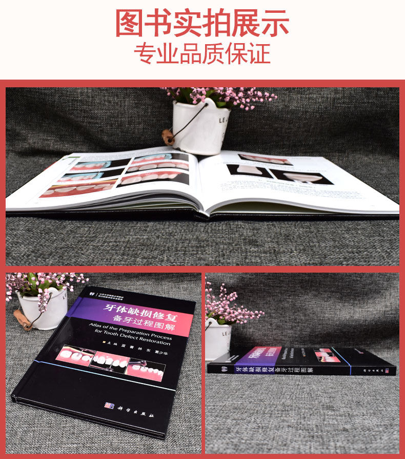 牙体缺损修复备牙过程图解 山东大学精品立项教材 供口腔医学类专业使用蓝菁主编科学出版社9787030673015