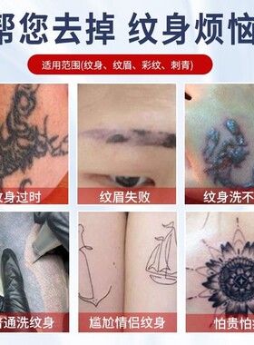 极速医生去纹身液去刺青纹身正品