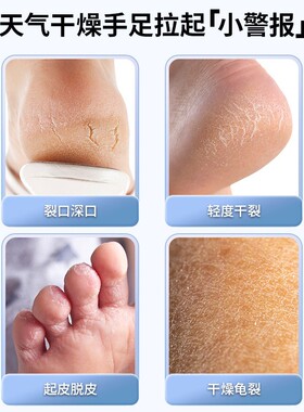 DoryThos比诗足部皴裂露去死皮