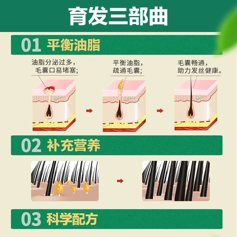 太阳神育发洗发水洗头膏露生姜防脱发控油男女正品官方品牌旗舰店 - 图0