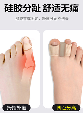 德国拇指外翻矫正器大脚趾头