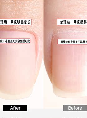 俄式前置处理打磨头多型号可选