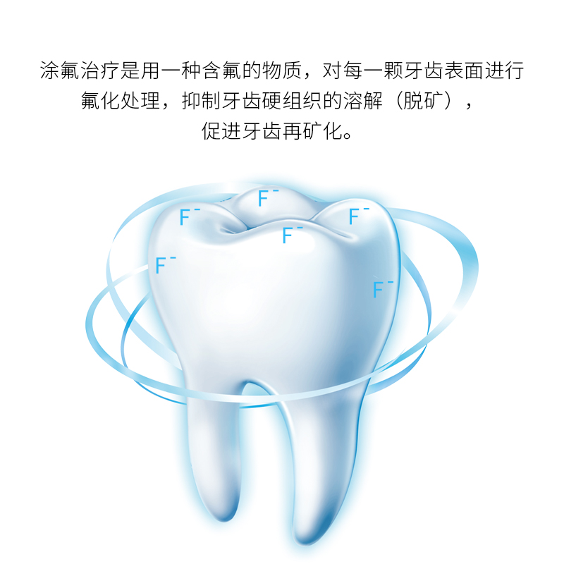 牙托涂氟氟化泡沫托盘护牙素美白牙膏涂抹护牙保持器护齿牙套硅胶