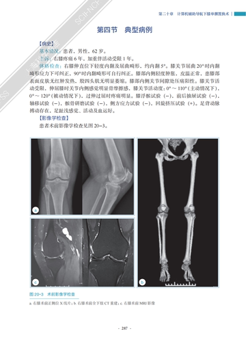 【2023新书】膝单髁置换术理论和实践涂意辉薛华明外科学骨科髁关节膝关节解剖运动学病理学生物力学单髁假体-图2