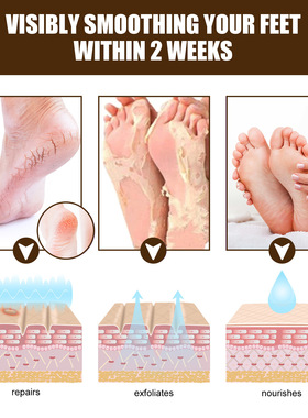 Herbal Anti Crack Foot Cream  Anti-Drying Crack Feet Cream