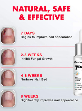 iBeaLee Repair Grey Nail Fungus Treatments Essence Foot Car