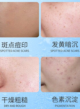 377美白淡斑提亮保湿精华乳液正