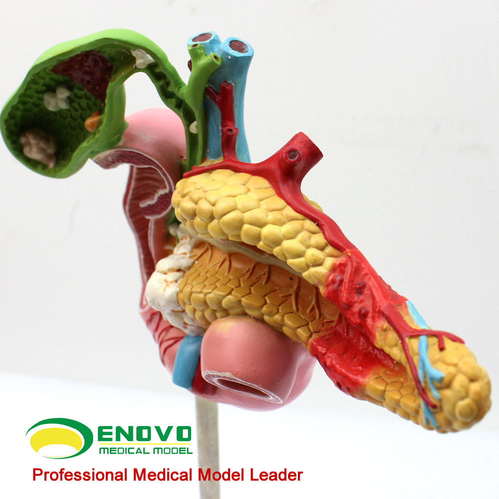 ENOVO颐诺医学胰腺十二指肠胆囊病理模型外科消化科系统模具肝胆科模型专科医生医学住院医师教学上海教具,淘宝优惠券,粉丝福利购,淘宝优惠卷