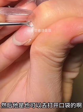 双头甲沟专用剔甲器炎脚趾甲