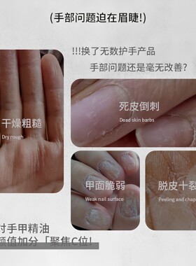 乌木玫瑰香氛滋润营养油护理手部指缘精油保湿精油防倒刺