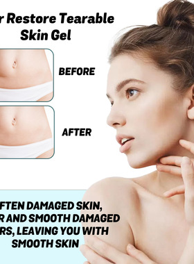 Scar Gel Nourishing Repairing Smoothing Body Skin Fading Sca