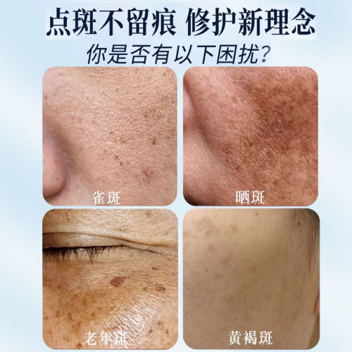 点斑专用药水祛斑精华液分解黑色素不留疤斑去黄褐雀斑官方正品# - 图0