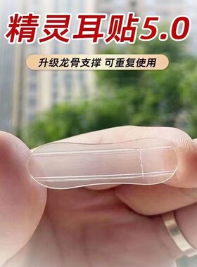 精灵耳支撑器隐形无痛强支撑