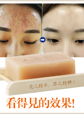 茶树精油手工洁面皂深层去油