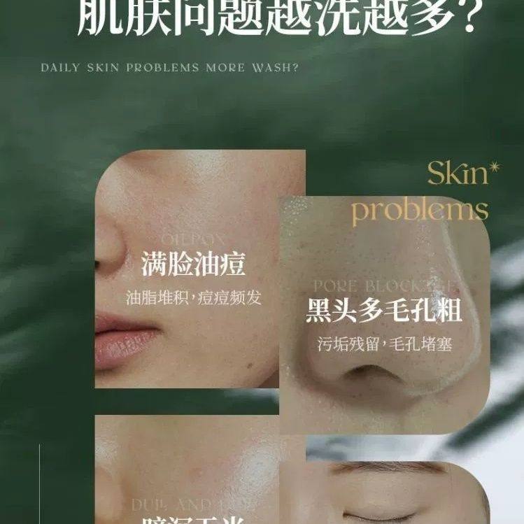 OHBT澳白愈创木洗面奶控油祛痘去黑头收缩毛孔氨基酸洁面乳,淘宝优惠券,粉丝福利购,淘宝优惠卷