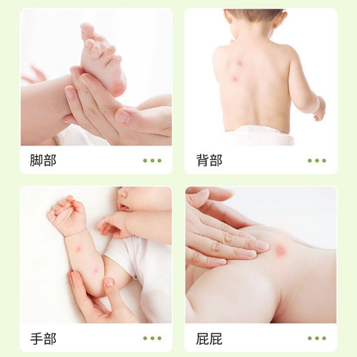 紫草膏婴儿专用舒缓叮叮棒宝宝蚊子蚊虫叮咬儿童孕妇草本膏 - 图3