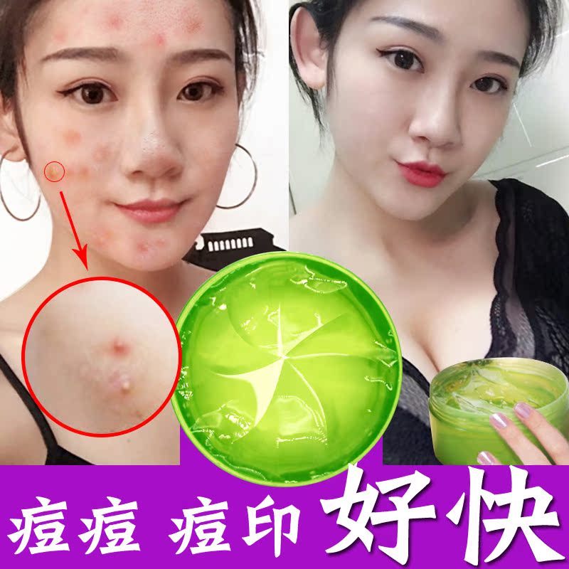 300g 蘆薈凝膠正品曬后修護凝膠補水保濕免洗睡眠面膜控油淡化痘印 300g 蘆薈凝膠正品曬后修護凝膠補水保濕免洗睡眠面膜控油淡化痘印