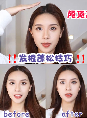 韩国发根蓬松夹头顶头发定型自助
