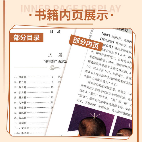 人卫正版 靳三针临症配穴法 第2二版 中医针刺操作临床心得柴铁劬 针灸穴名解对常见多发病治疗人民卫生出版社临症配穴疗法入门书 - 图2