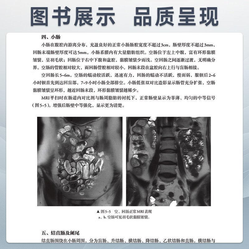 医学影像学第5版 成教专升本临床配增值 国家卫生健康委员会十四五规划新形态教材 全国高等学校教材9787117363648人民卫生出版社
