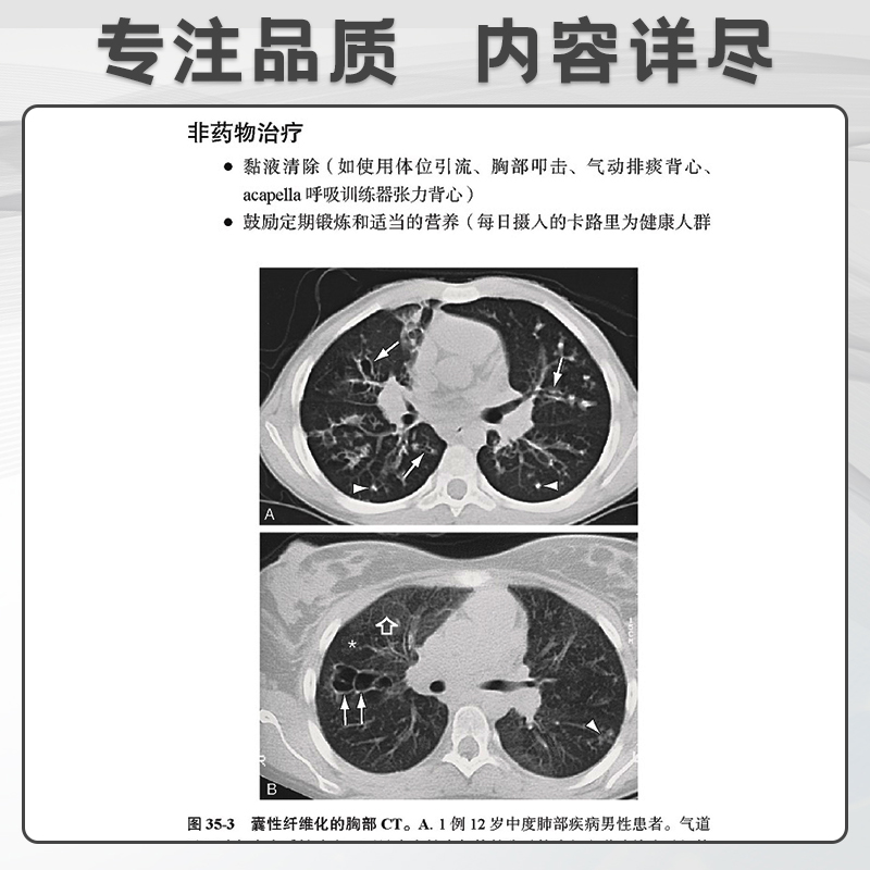 Ferri临床诊疗指南.呼吸系统疾病诊疗速查手册 弗雷德费里 著 供部分全科医生及医学生等参考 北京大学医学出版社 9787565924620 - 图1