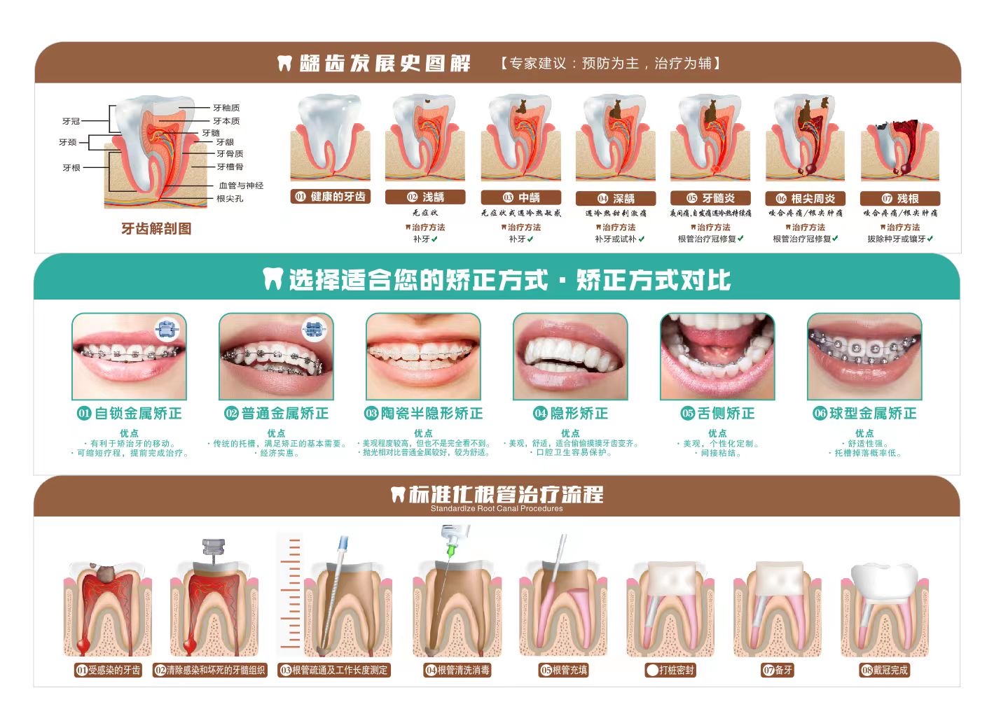 根管治疗定制模型办公医患沟通标识牙科沟通工具 - 图2