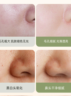绿茶清洁泥膜收缩毛孔去黑头闭口粉刺深层清洁补水涂抹式面膜男女