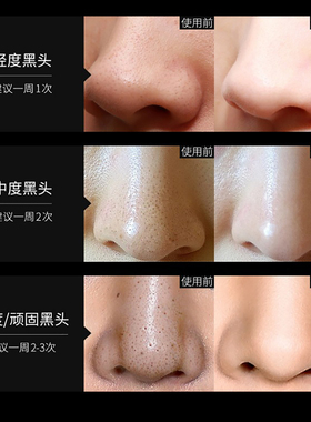 竹炭泥撕拉涂抹面膜补水深层清洁祛痘收缩毛孔去黑头粉刺鼻贴男女