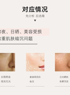 氨甲环酸精华提亮白调理去黄气改善肌肤暗沉传明酸原液美容院正品