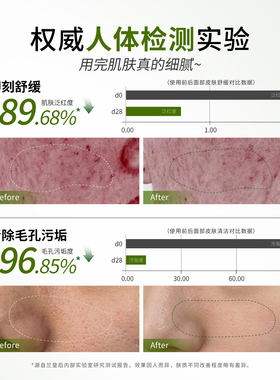 超分子肽舒缓小气泡洁颜露洗面奶