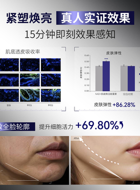 新款兰皇后 NAD+肌能焕活能量素 紧致淡纹收缩毛孔安瓶次抛精华