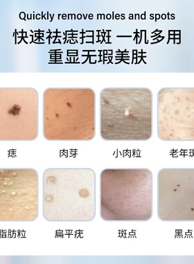 点痣笔美容院专用小白扫斑点痣专用笔扁平疣仪器激光点斑消痣神器
