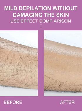 Reusable Crystal Hair Eraser Physical Bleame Hair Removal To