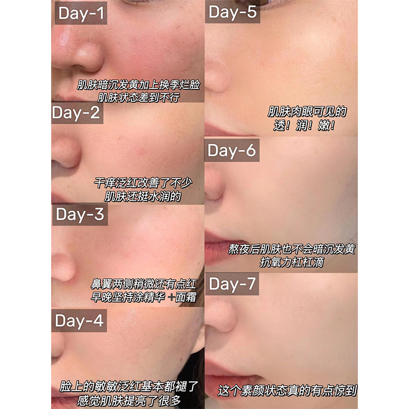 Topix replenix绿茶多酚修护面霜夜间精华晚霜50g 修复屏障早晚 - 图1