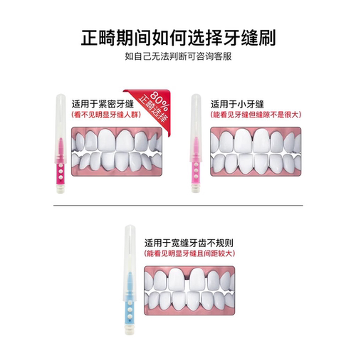 奈森克林l型牙缝刷正畸牙刷矫正牙齿软毛牙线间隙刷牙齿间刷 - 图2