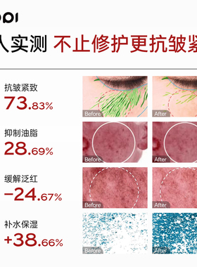 dopi玉颜润肌水嫩精华乳舒缓保湿修护褪红敏感肌护肤乳液官方正品