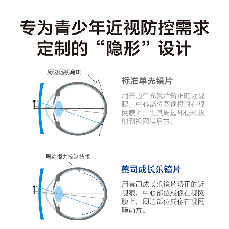 蔡司儿童成长乐离焦防控镜片延缓近视加深铂金膜官方授权实体店