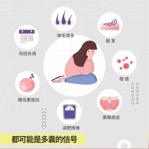 正版】多囊卵巢综合征完全指南 梁湛威患者的自救指南检测指标全面解析系统饮食调节建议好孕从卵子开始作者北京科学技术出版社 - 图1