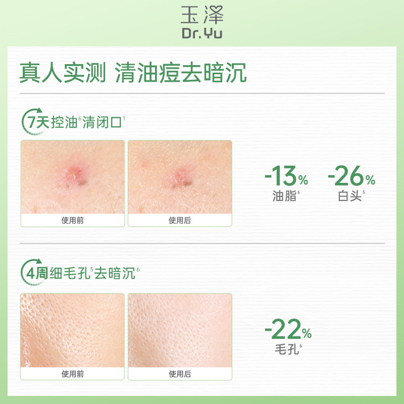 玉泽净颜控油爽肤水油痘肌温和修护屏障清爽补水保湿化妆水保湿水