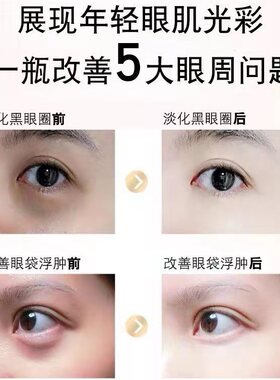 蛇毒眼霜提拉祛眼纹淡黑眼圈