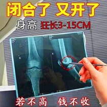 Farewell to short 6 to 48 years of effective upgraded version to help you get rid of your worries and buy 5 5 men and women universal