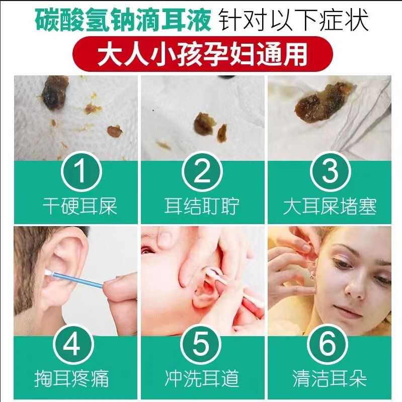 专业采耳滴耳液儿童耳结软化水洗耳液碳酸氢钠掏耳神器耳屎耵聍水