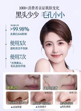 去黑头鼻贴草莓鼻白鼻贴清洁毛孔粉刺撕拉式猪鼻贴膜污垢鼻头神器