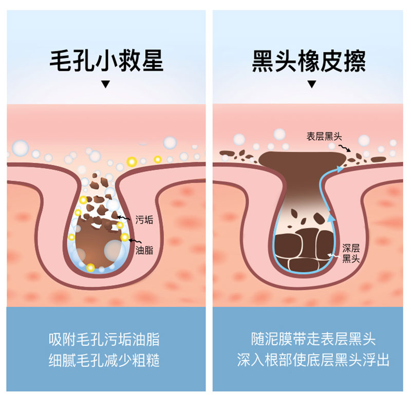 韩国eiio小白泥清洁面膜泥膜去黑头粉刺收缩毛孔深层清洁涂抹式女 - 图1